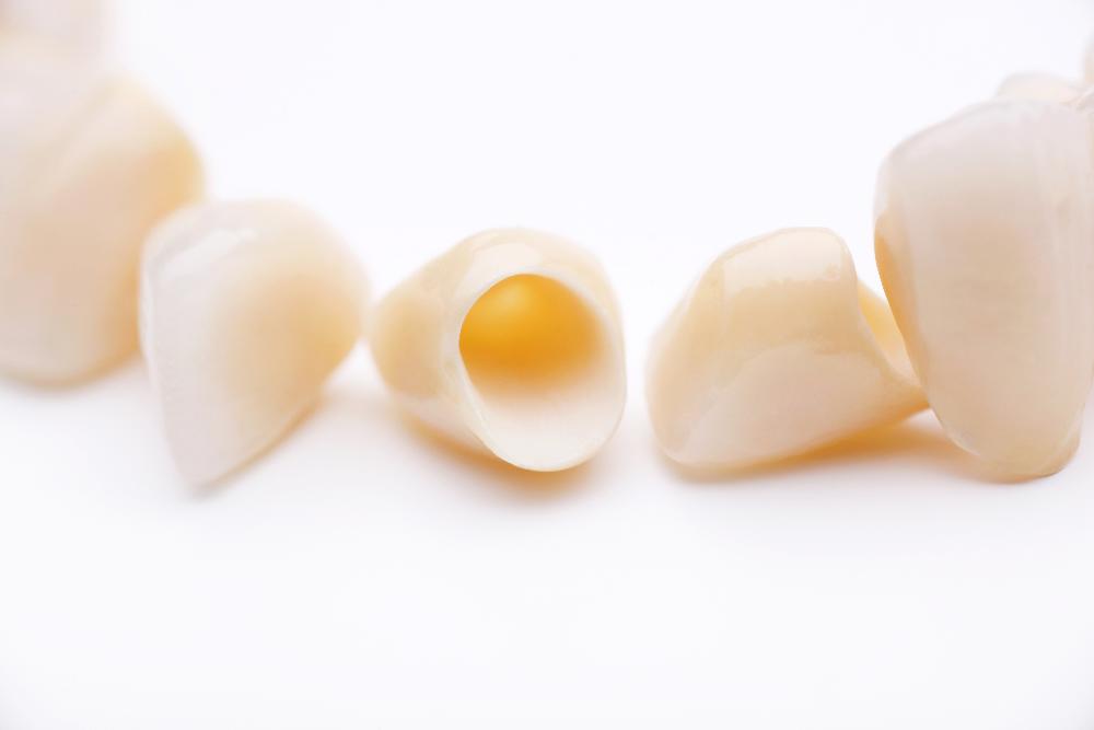 Dental crowns in Kurri Kurri and Raymond Terrace