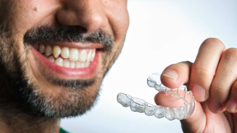 A smiling man putting in his clear aligners in raymond terrace